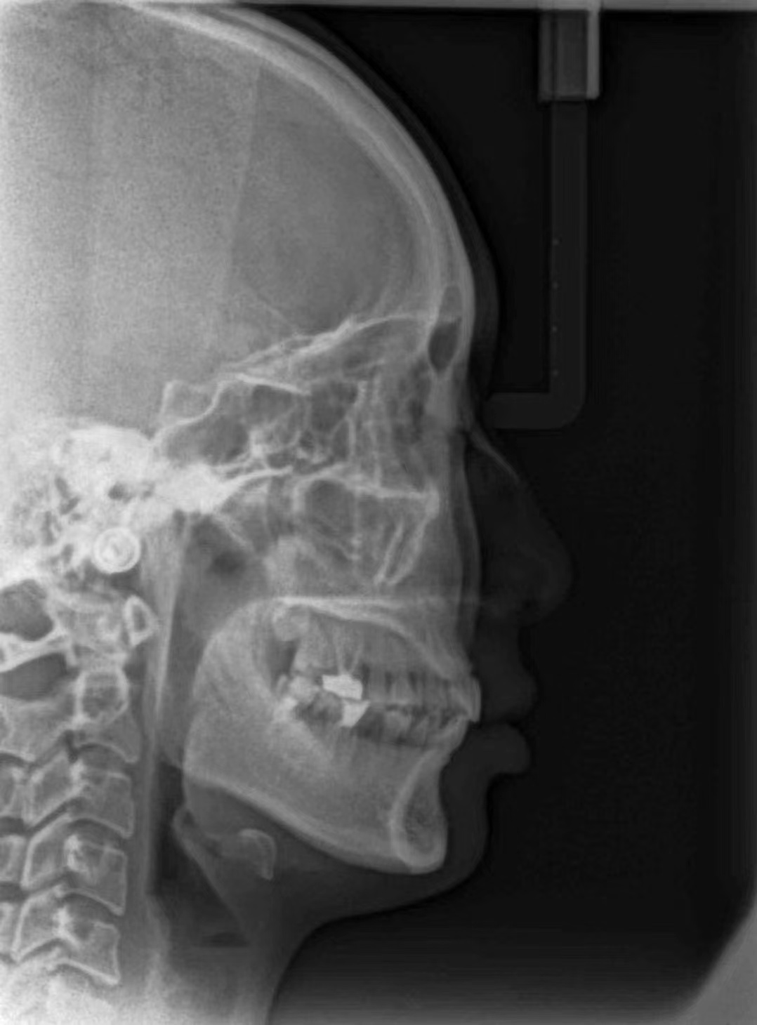 Carestream CS8000C Used Dental Pano+Ceph