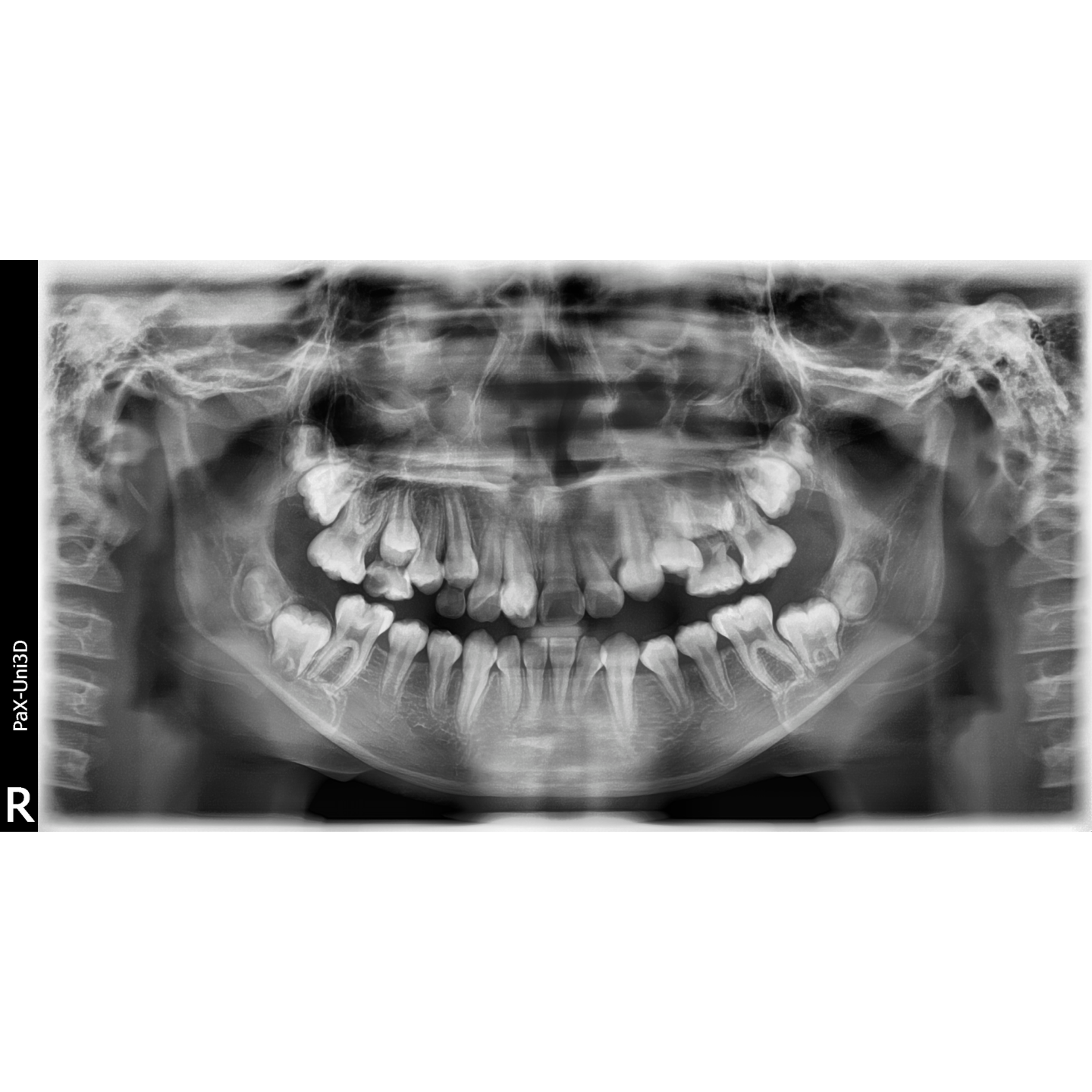 Vatech PaX-Uni3D Used Dental Pano+Ceph+CBCT