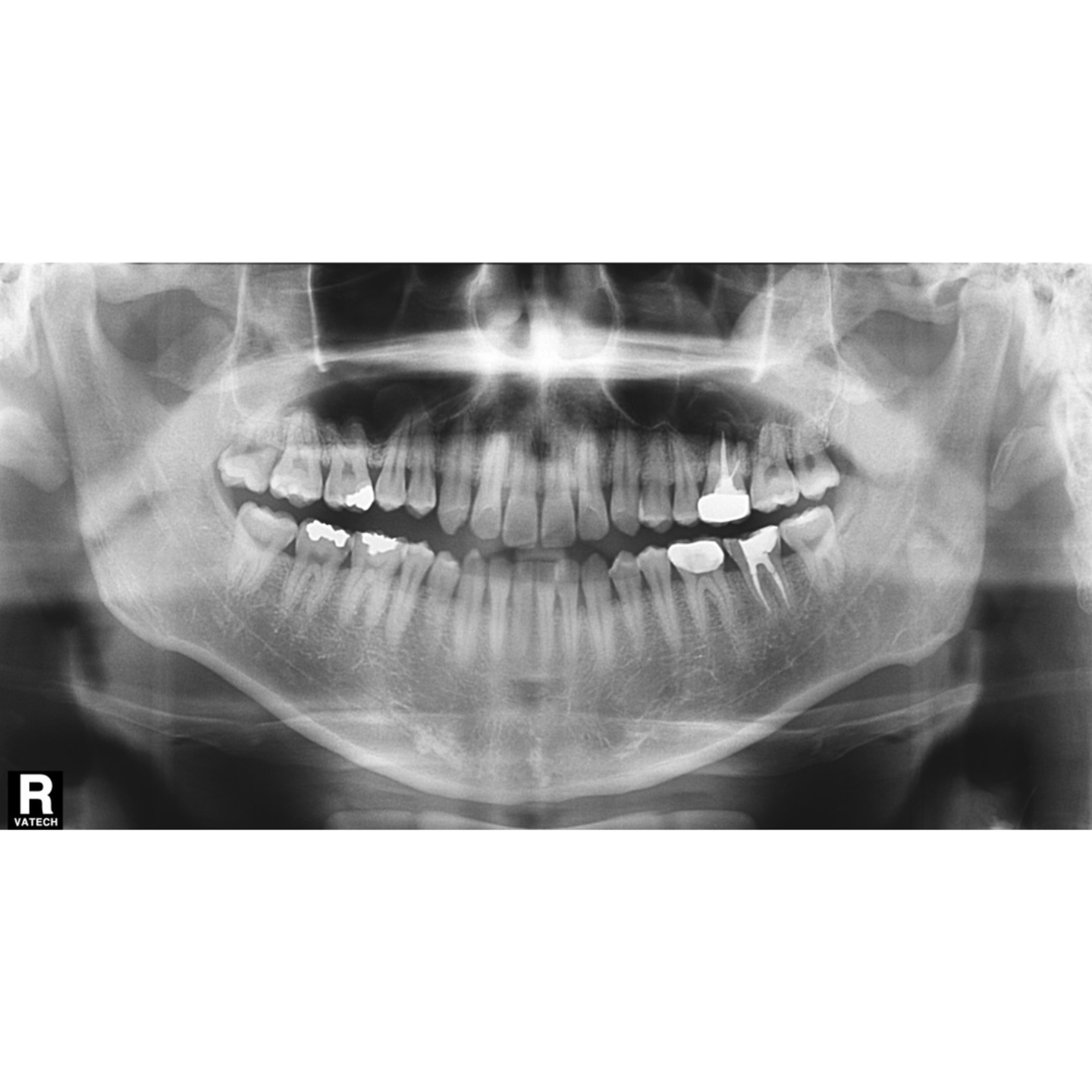 Vatech Implagraphy Used Dental Pano+Ceph+CBCT