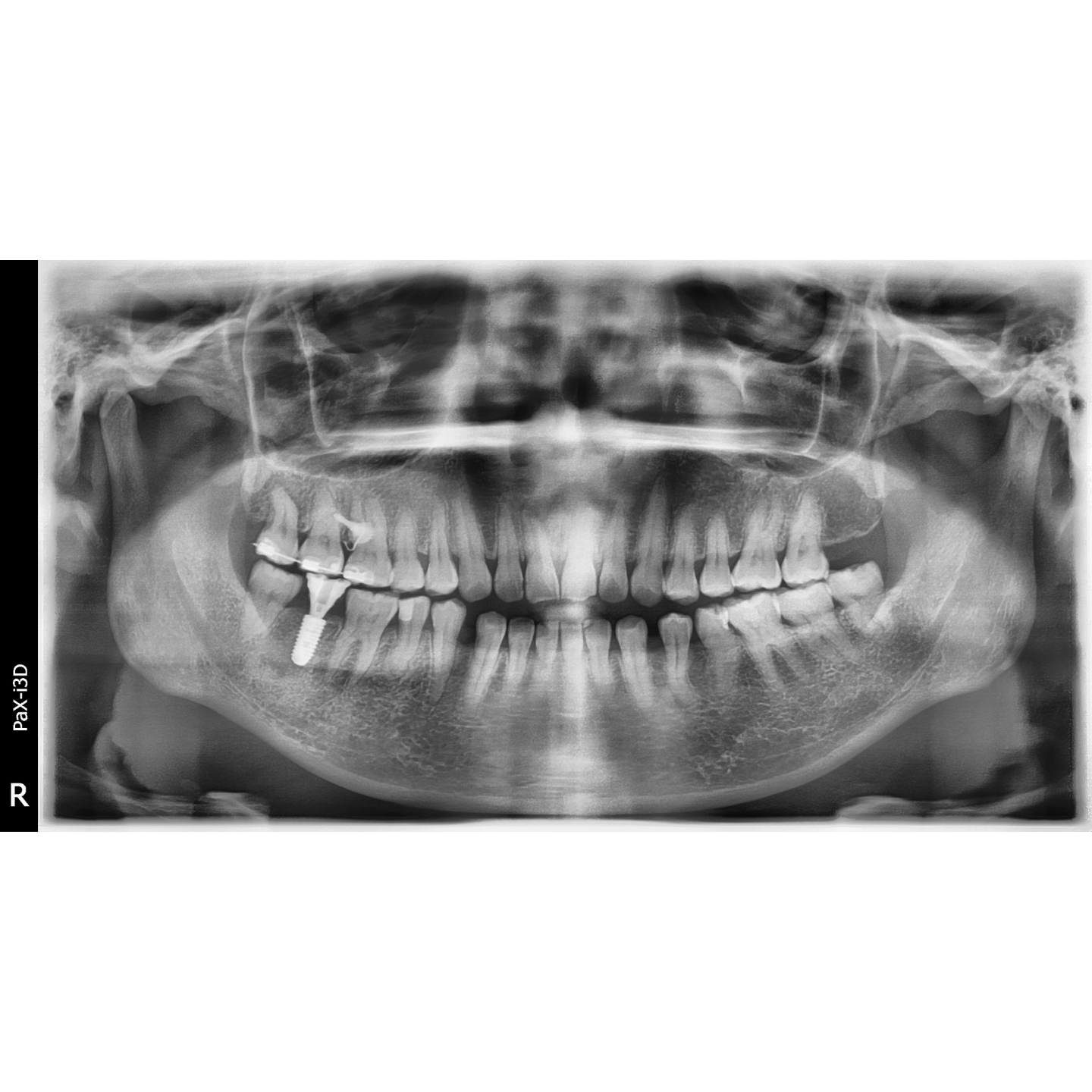 Vatech PaX-i3D SC Used Dental Pano+Ceph+CBCT