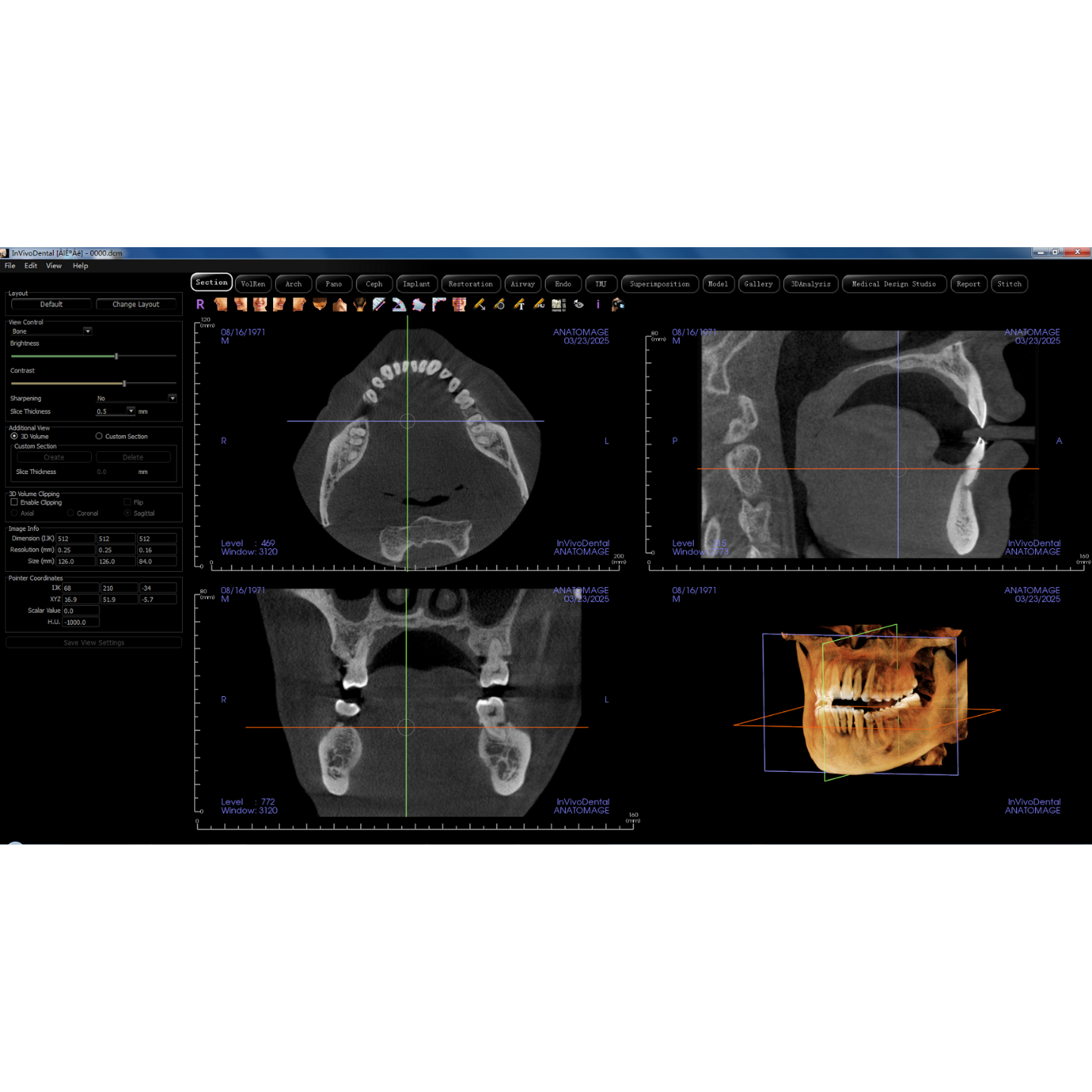 Fussen Dentrix 20 Used Dental CBCT