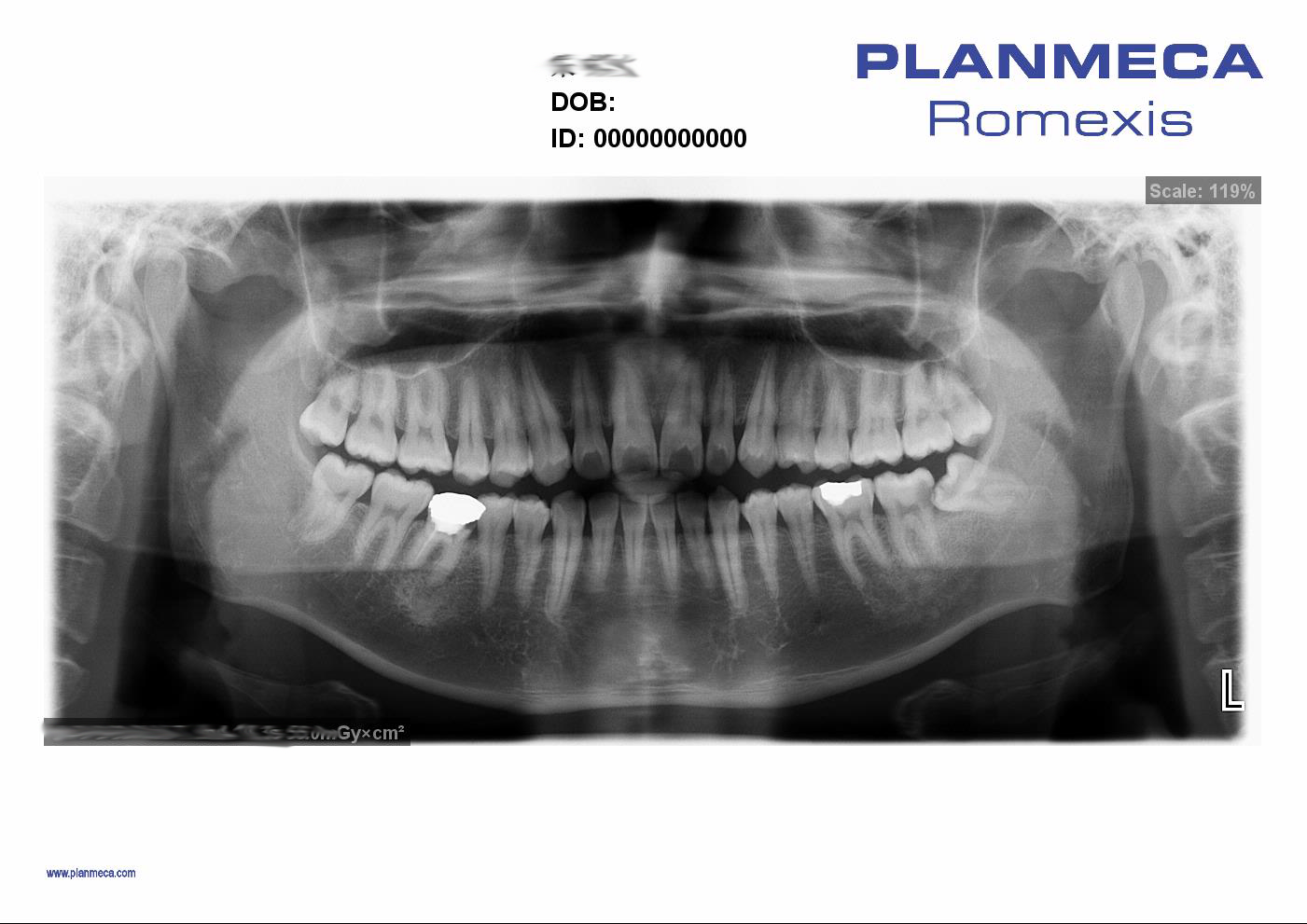 Máy chụp X-quang Toàn cảnh Nha khoa Planmeca ProOne