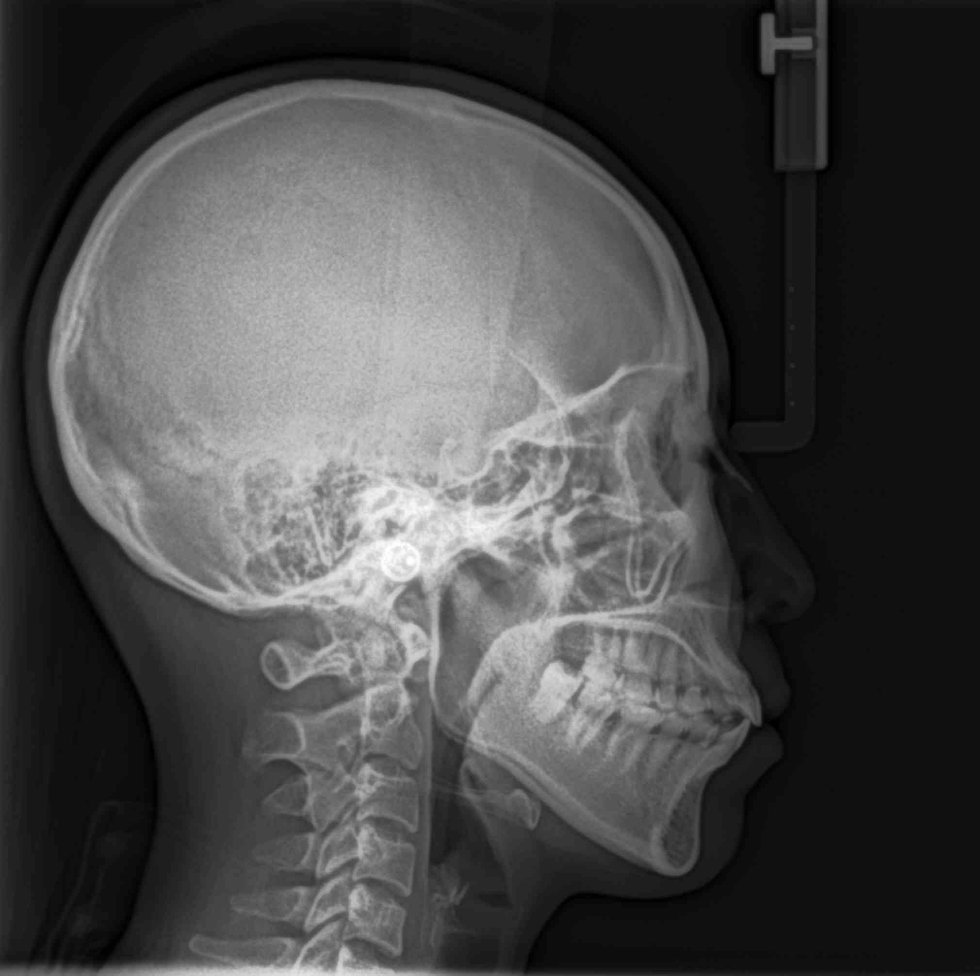 Carestream CS9000C Máy Chụp X-quang Nha Khoa Toàn Cảnh + Sọ Nghiêng Đã Qua Sử Dụng