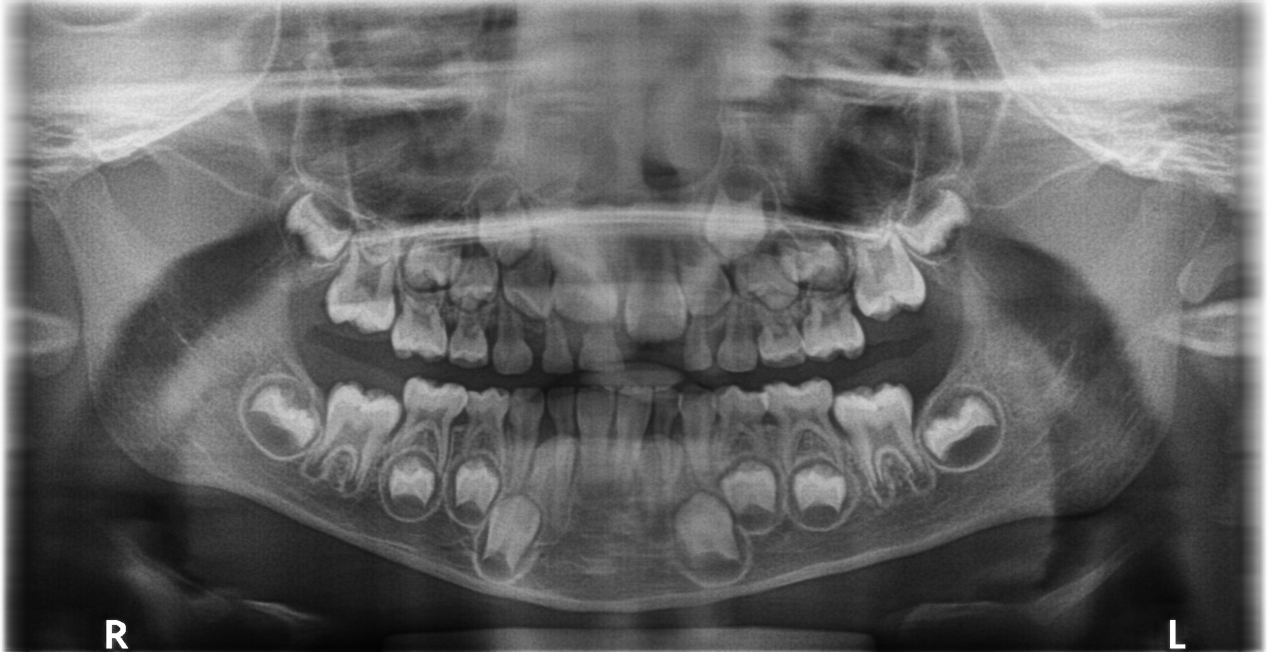 Hệ thống Carestream CS9300Select – Máy toàn cảnh + Ceph + CBCT nha khoa đã qua sử dụng CBCT nha khoa đã qua sử dụng