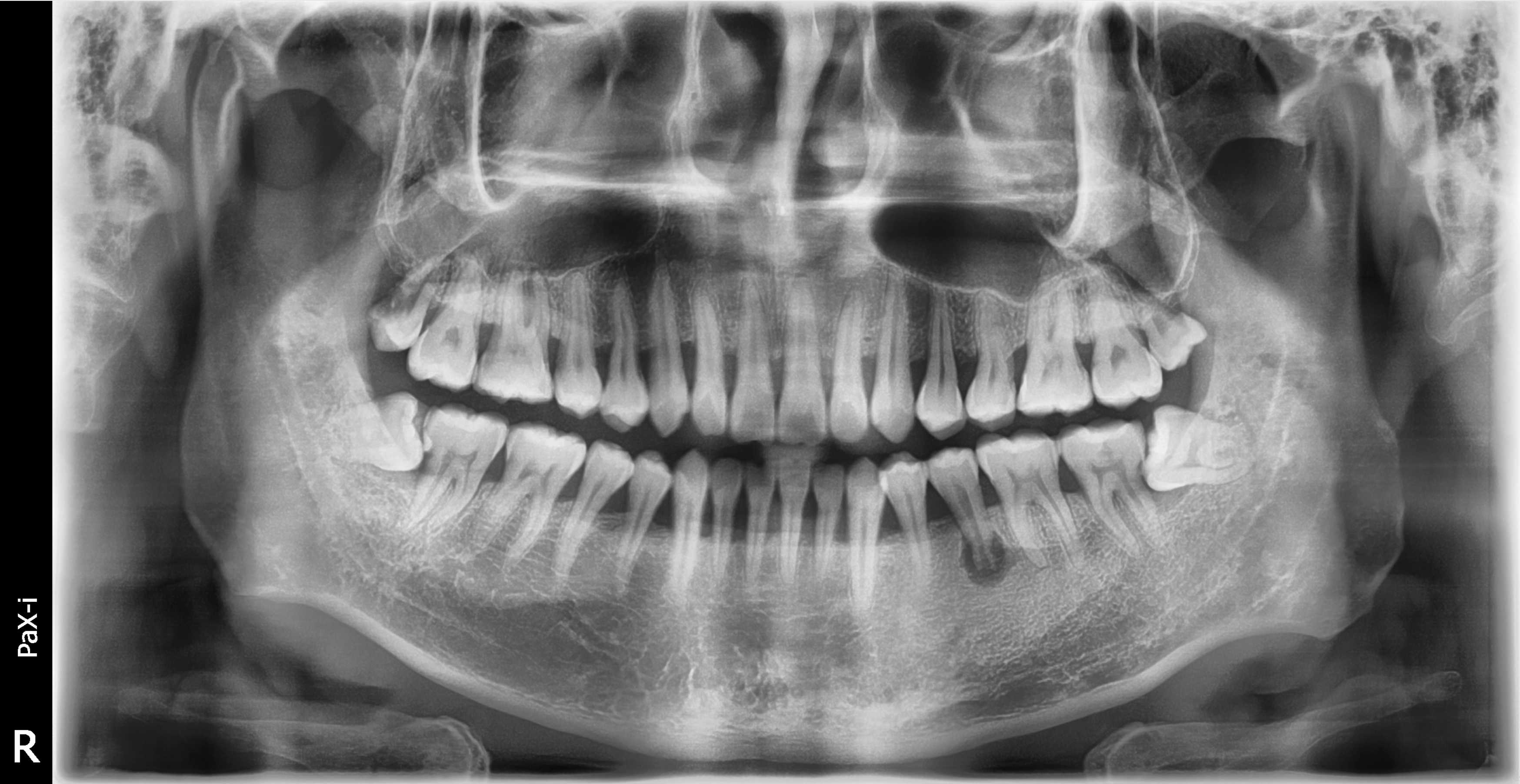 Vatech PaX-i Used Dental Pano