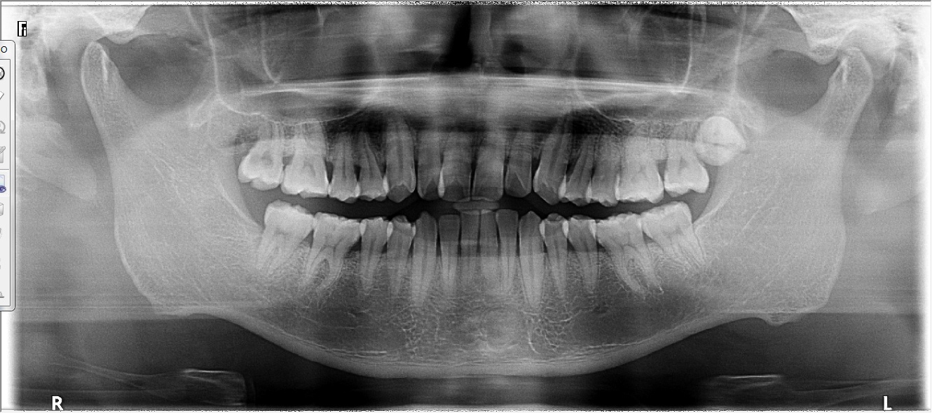 Carestream CS9000C Máy Chụp X-quang Nha Khoa Toàn Cảnh + Sọ Nghiêng Đã Qua Sử Dụng