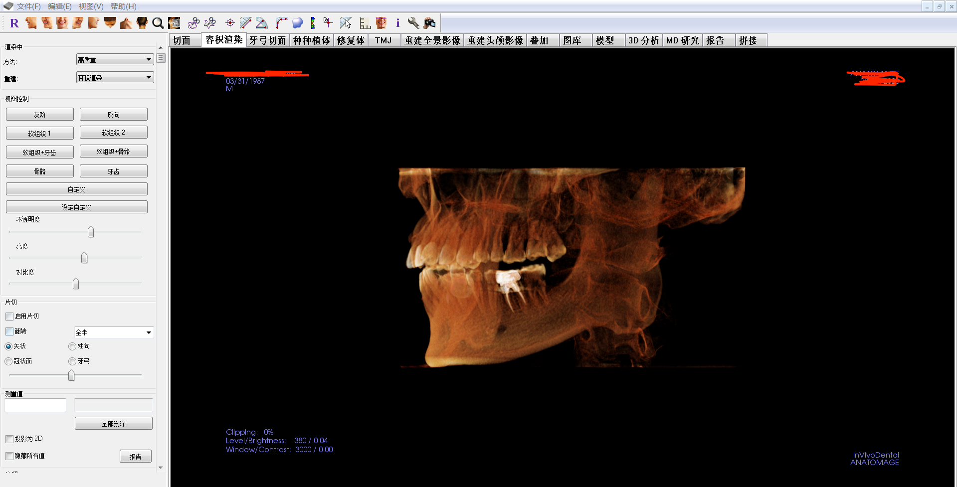 KaVo 3D eXam i Hệ Thống CBCT Nha Khoa – Máy Chụp CBCT Đã Qua Sử Dụng