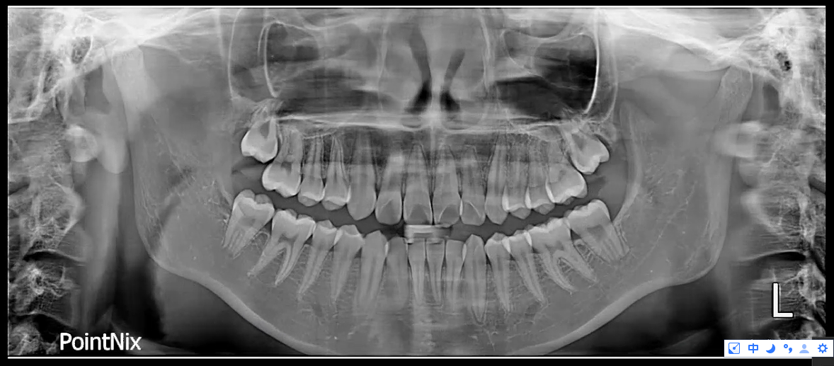 Hệ thống Point 800S HD 3D Plus – Máy toàn cảnh + Ceph + CBCT nha khoa đã qua sử dụng CBCT nha khoa đã qua sử dụng