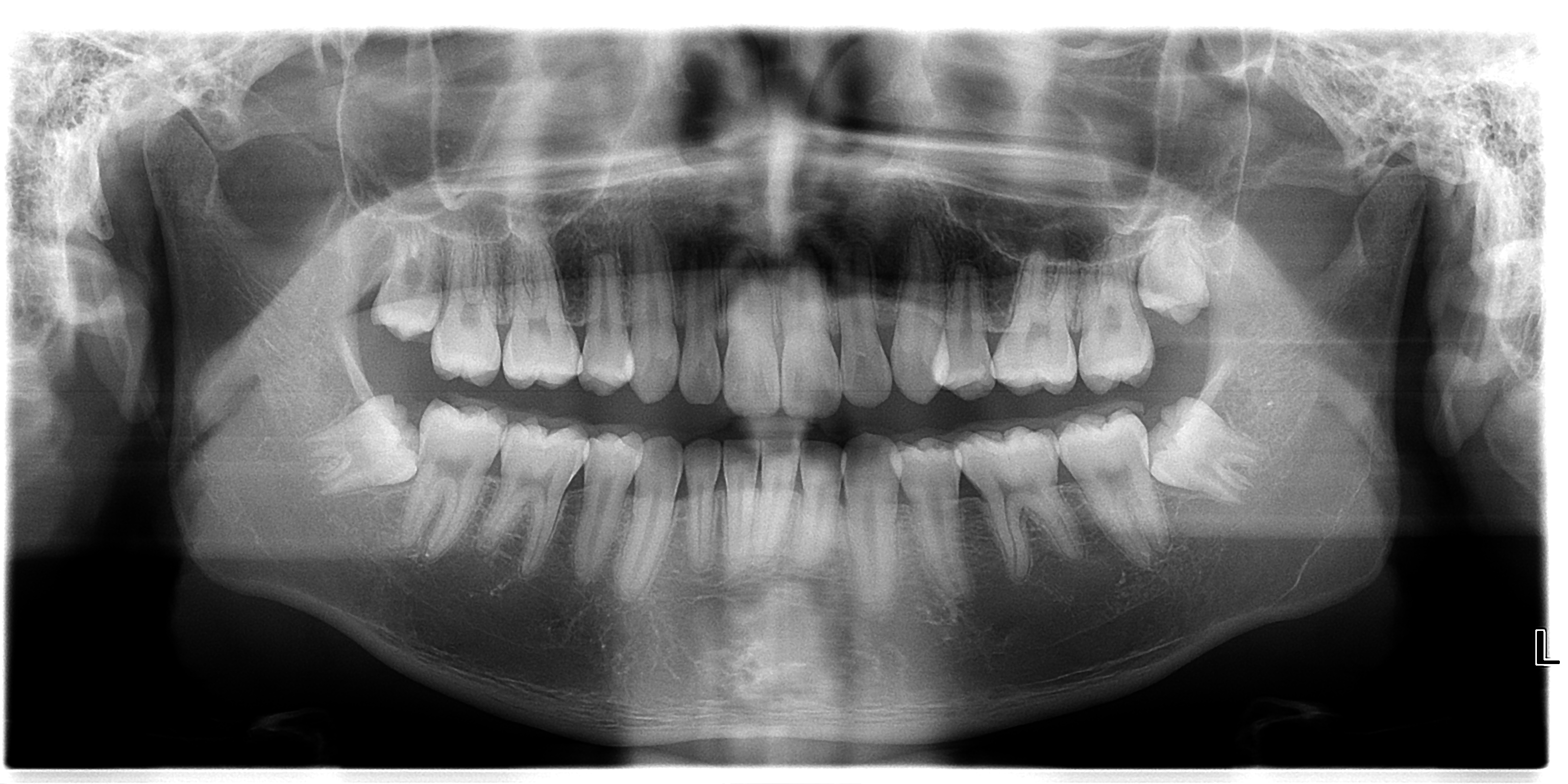 Máy chụp X-quang toàn cảnh nha khoa đã qua sử dụng KaVo Pan eXam