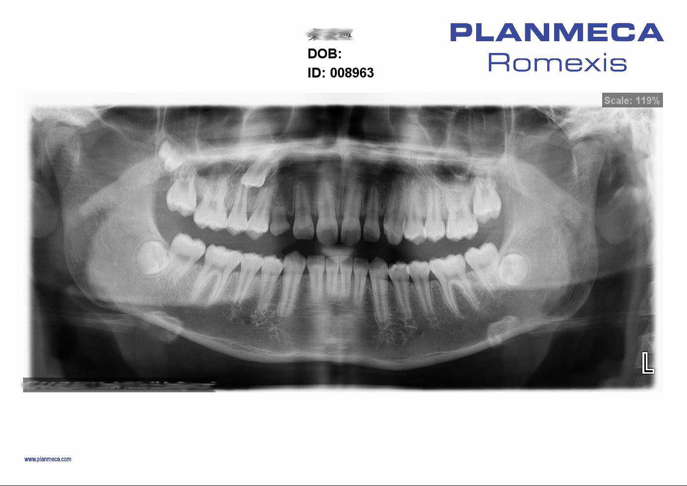 Máy chụp X-quang Toàn cảnh Nha khoa Planmeca ProOne
