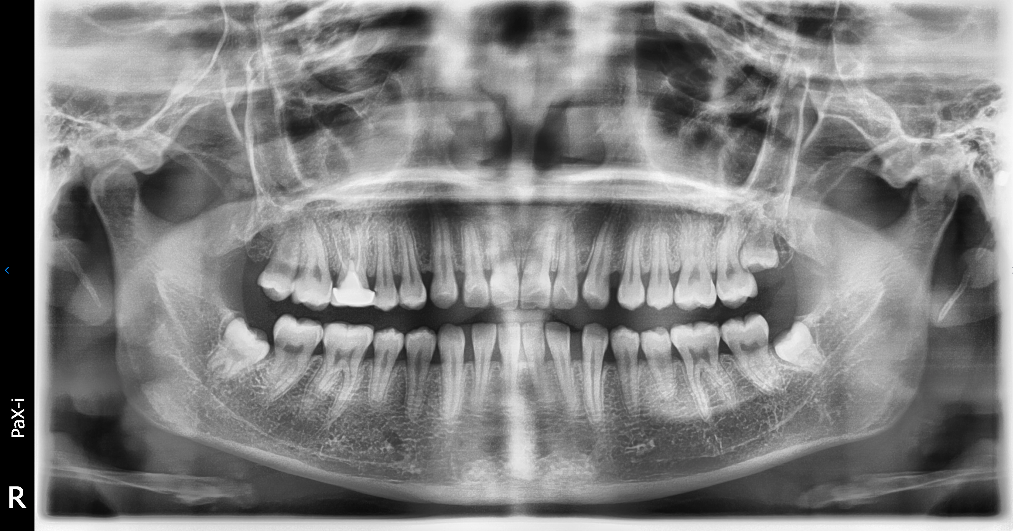 Vatech PaX-i Used Dental Pano