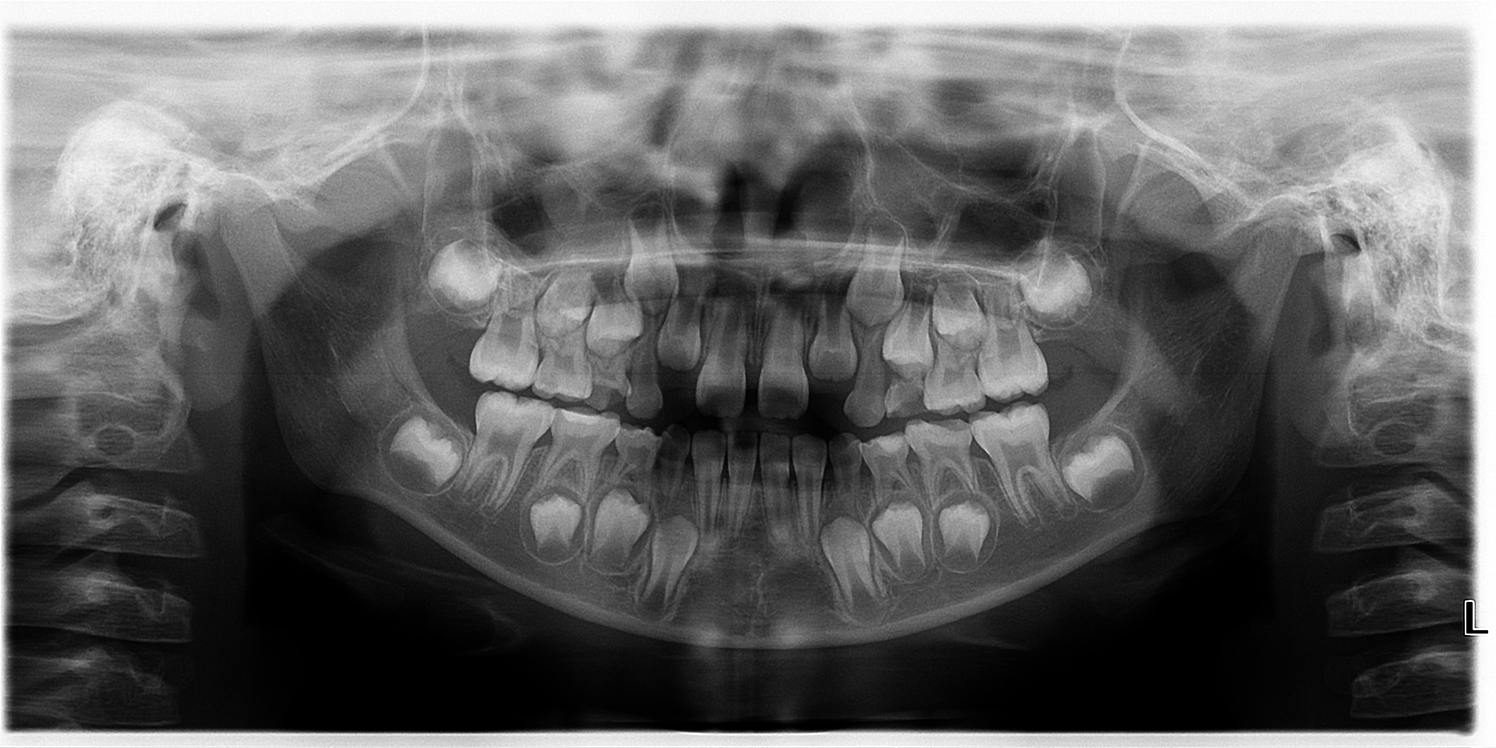 Máy chụp X-quang toàn cảnh nha khoa đã qua sử dụng KaVo Pan eXam
