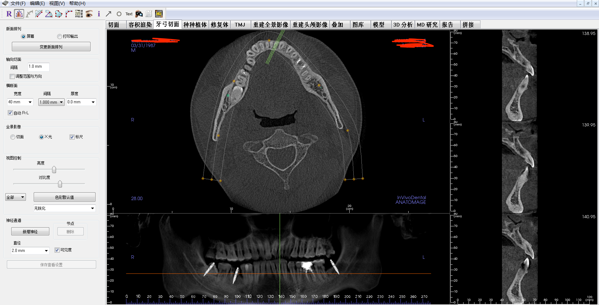 KaVo 3D eXam i Hệ Thống CBCT Nha Khoa – Máy Chụp CBCT Đã Qua Sử Dụng