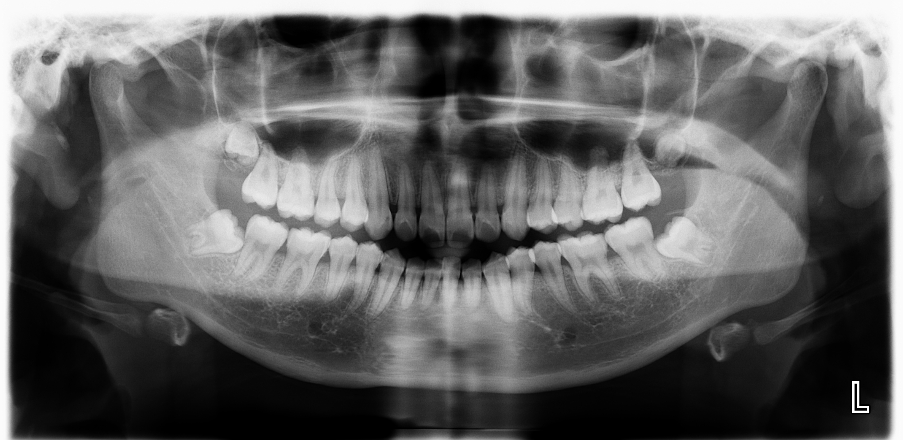 Máy Planmeca ProMax Chụp X-quang Nha Khoa Toàn Cảnh + Sọ Nghiêng Đã Qua Sử Dụng