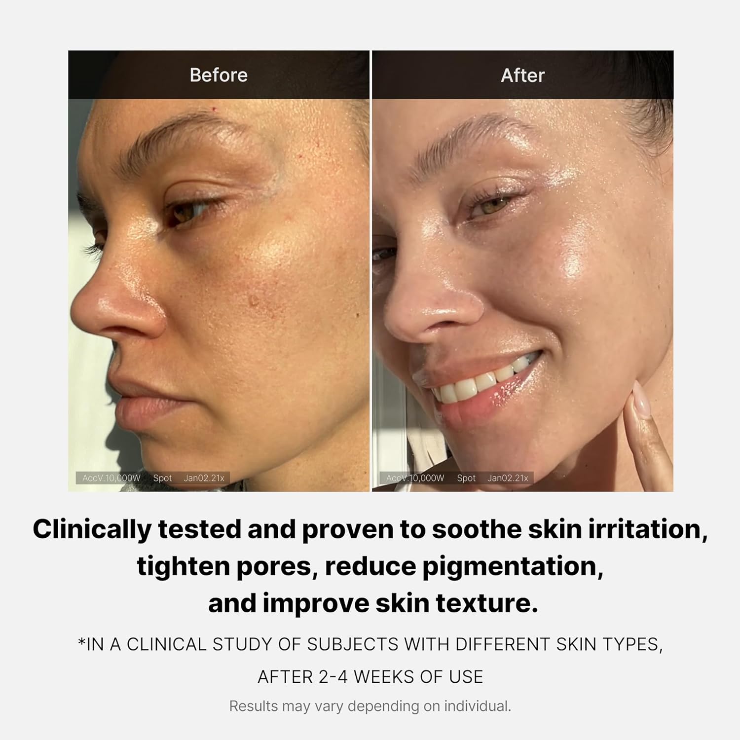 Medicube Triple Deep Erasing Cream || A slugging-worthy Collagen cream gives dewy & glowy skin | Inner hydration +3.5% & Outer hydration +11% |Hyaluronic Acid, Collagen Cica | Korean skincare