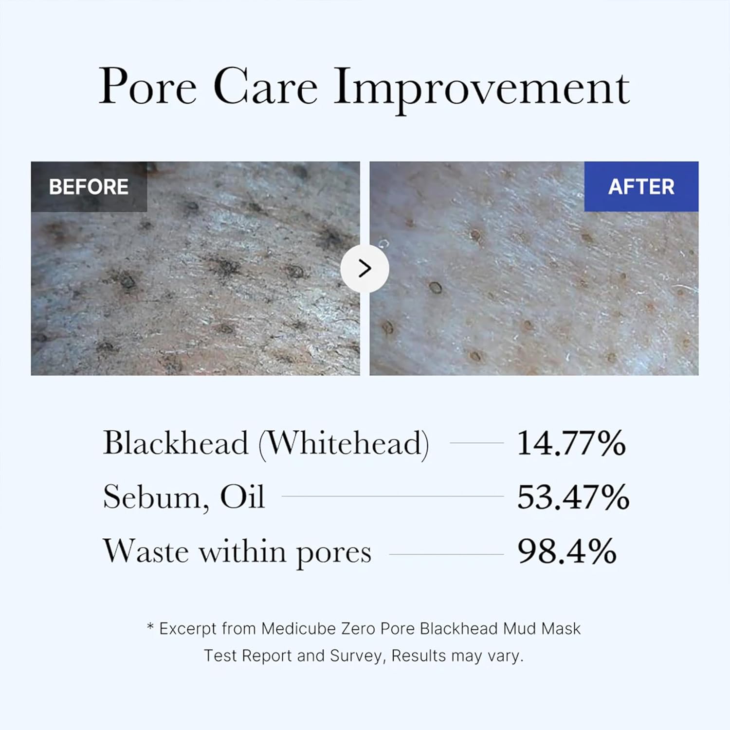 Medicube Zero Pore Blackhead Mud Facial Mask - Skin Cooling & Pore Tightening - 3 Minute Quick Dry Formula with AHA, BHA, PHA, and Pore-Purifying Clay - Korean Mud Mask 100 Grams