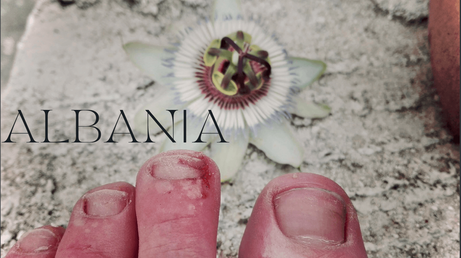 Feet - the History of Freedom