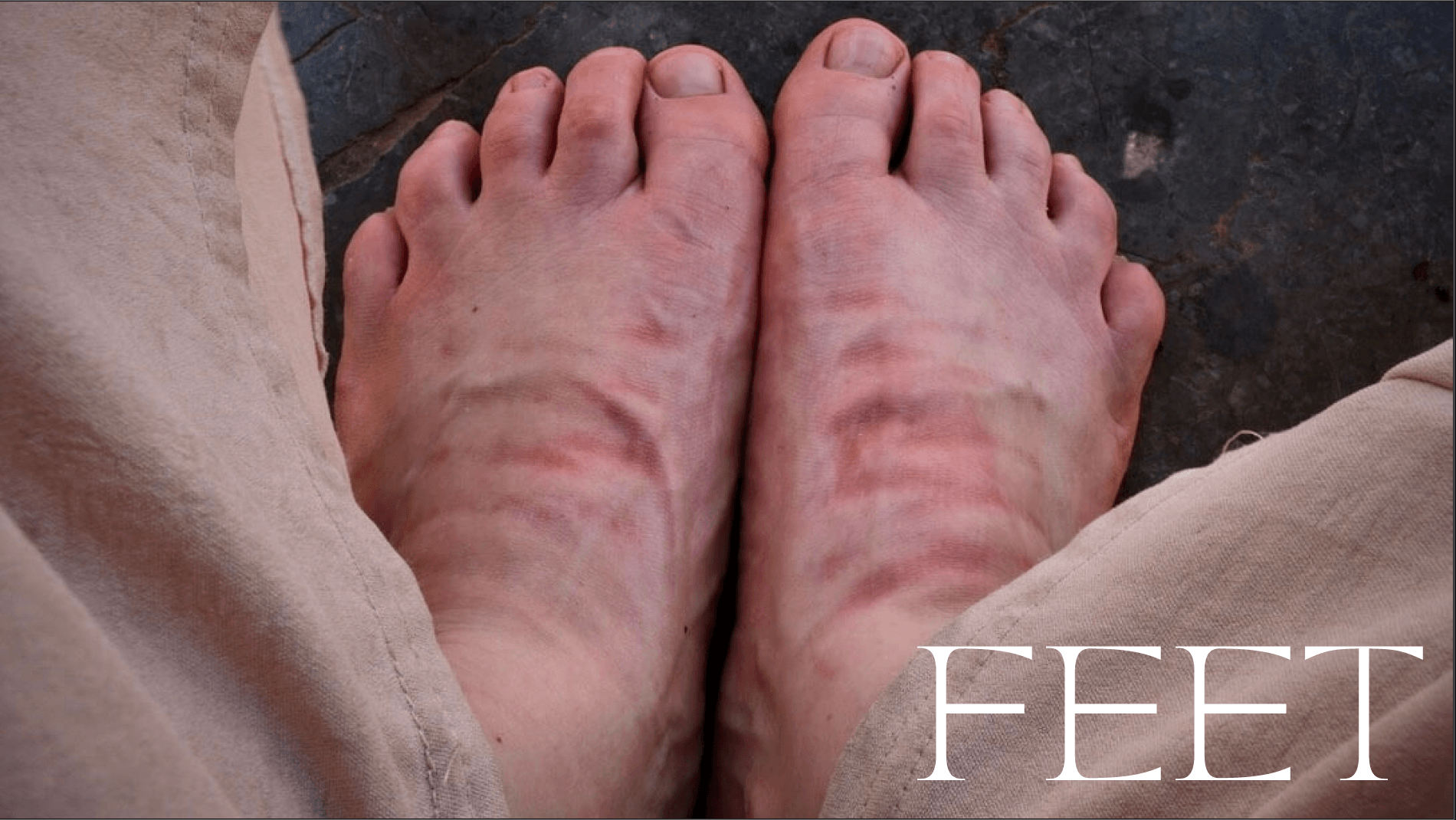 Feet - the History of Freedom