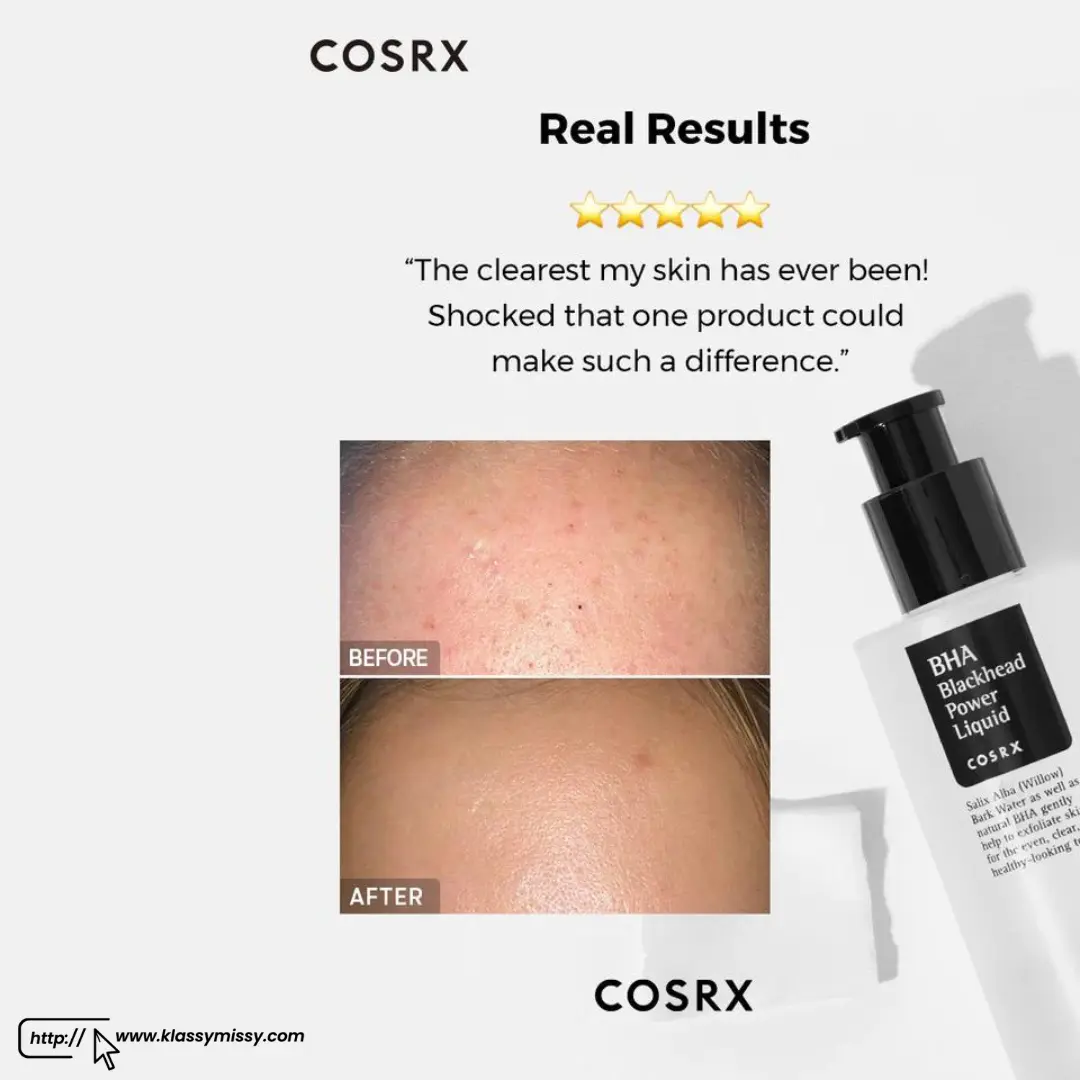 Cosrx BHA Blackhead Power Liquid 100ml
