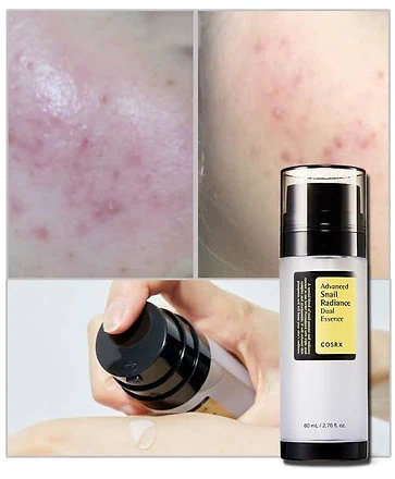 Cosrx Advanced Snail Radiance Dual Essence 80ml