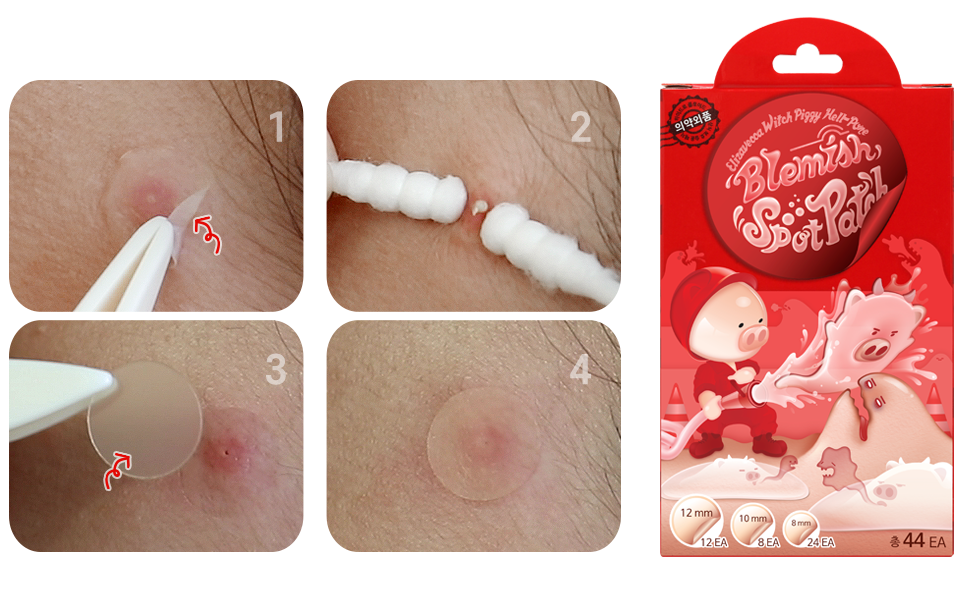 Elizavecca Acne Cover blemish Spot Patch Hydrocolloid Patches 44 + 44 = 88 (12 mm 12 Count, 10 mm 8 Count, 8 mm 24 Count x 2) / 88 /spot patch