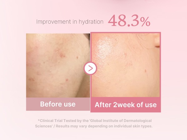 Medicube PDRN Pink Niacinamide Milky Toner 150ml