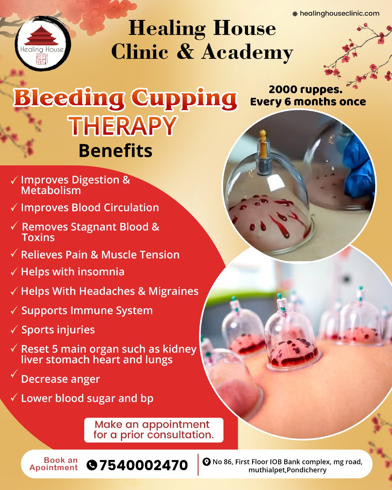 Bleeding Cupping Therapy : Secure An Appointment by paying booking fee