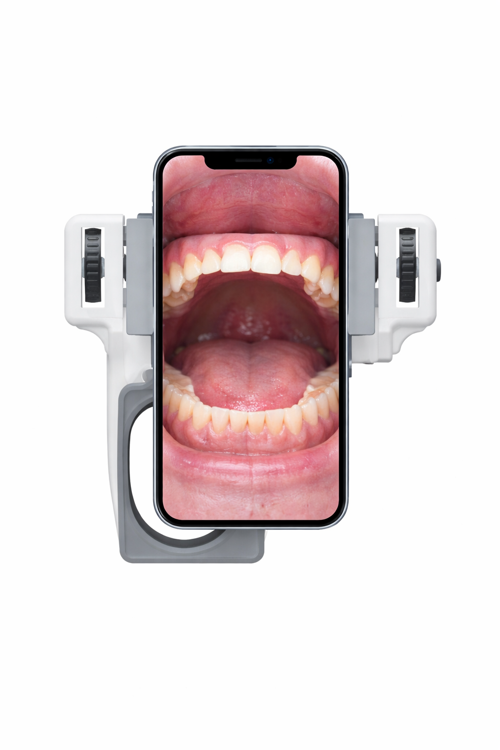 Fotografia Odontológica. Adaptador para Celulares.