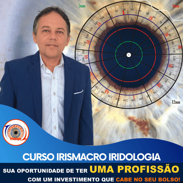 COMBO 4KP245- CURSO + IRISMACRO 4K + LICENÇA VITALÍCIA DO SOFTWARE IRISDIAG