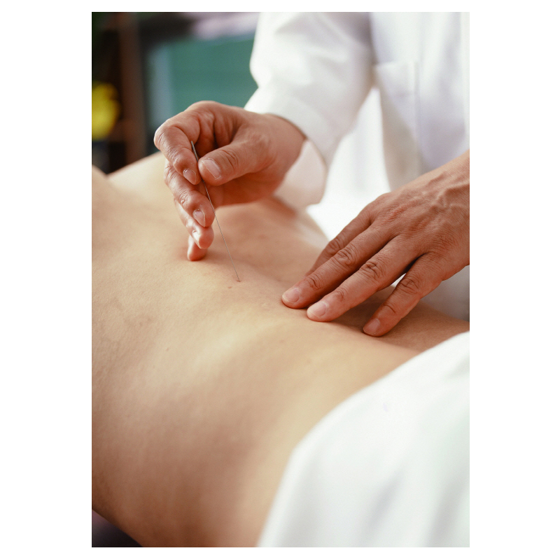 Agulhas para acupuntura Han Bang 0,20mm x 30mm com 1000 unidades