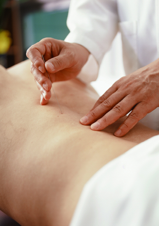 Agulhas para acupuntura Han Bang 0,25mm x 40mm com 1000 unidades