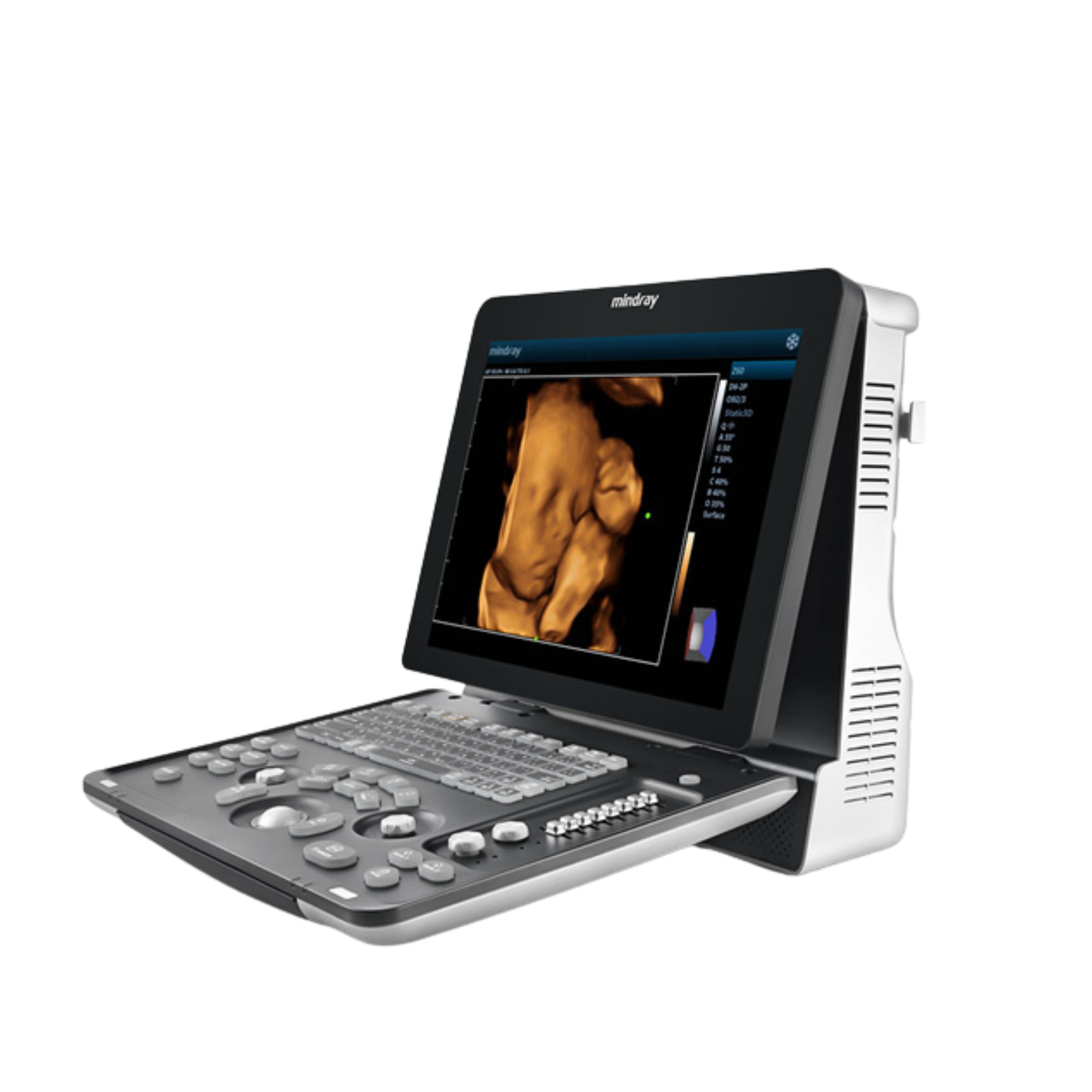 Mindray Z60 Exp 3D/4D