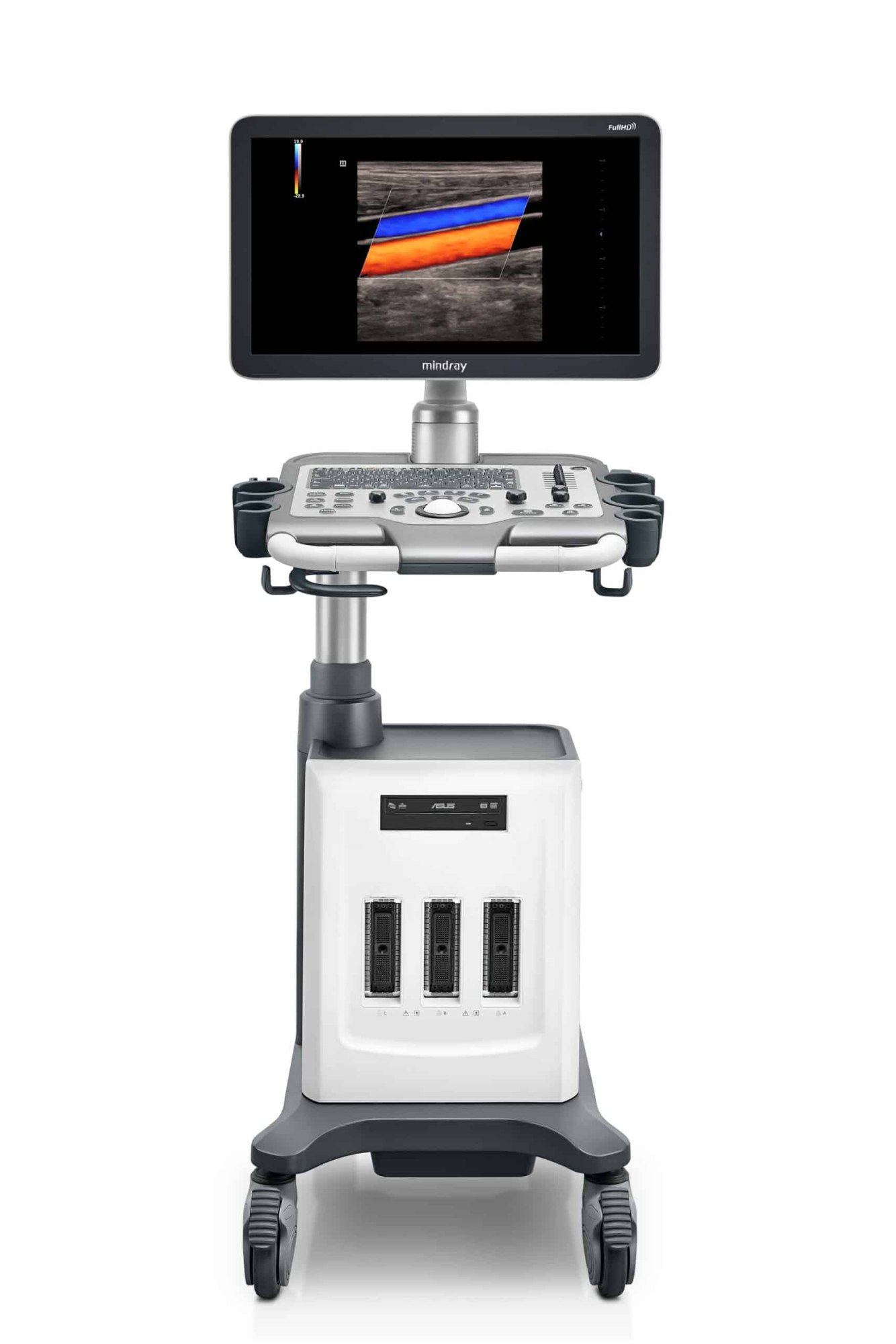 Mindray  DC-32 Full HD 3D/4D