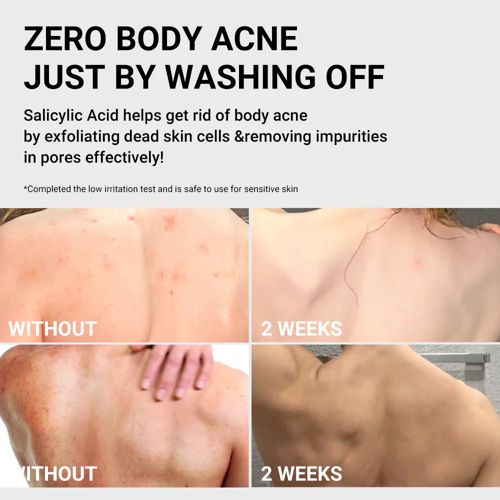 Rūgštinis kūno prausiklis „Red Acne Body Wash 2.0“