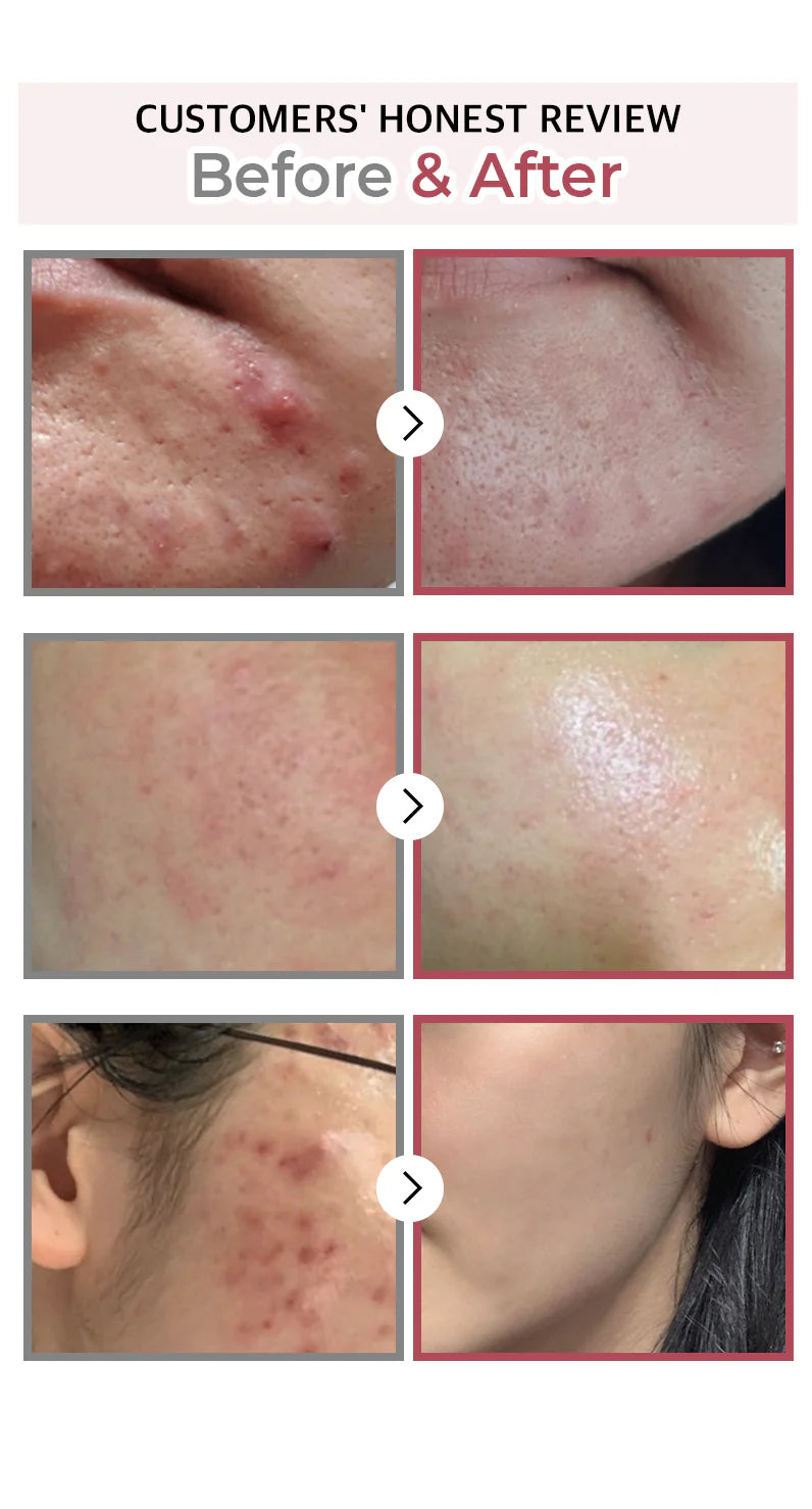 Atkuriamasis Serumas su Fermentuotu Galactomyces ir Bifida "No. 3 Skin Softening Serum"