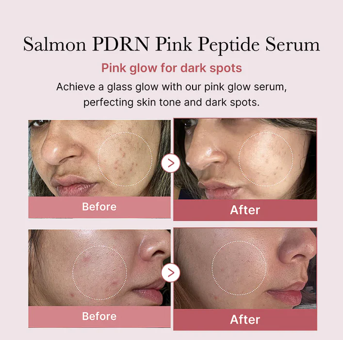 Atkuriamasis Veido serumas "PDRN Pink Peptide Serum"