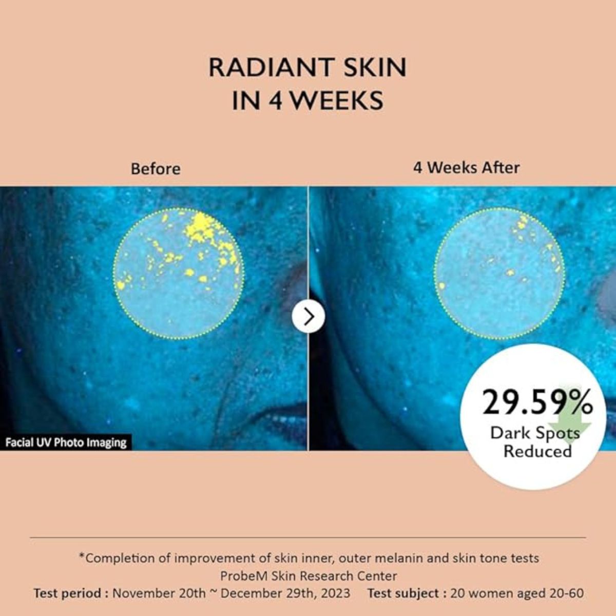 Dėmeles mažinantis veido serumas „Centella 4% TXA Dark Spot Go Away Serum“