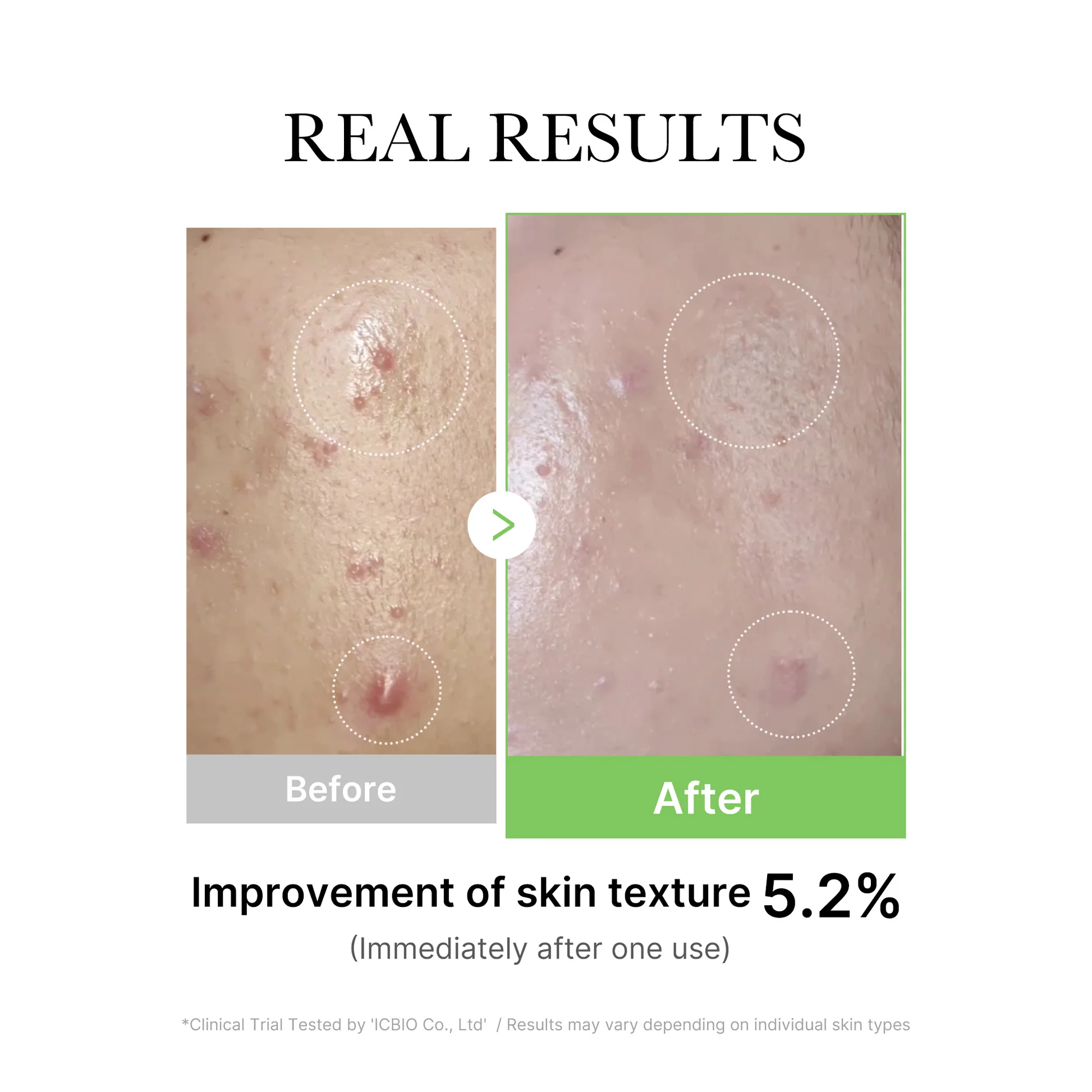 Veido Ampulė "Medicube Exosome Cica Ampoule"