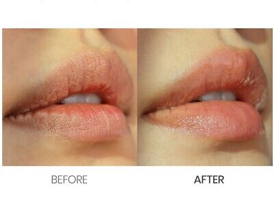 Lūpų esencija „ONE THING Moisturizing Lip Essence“