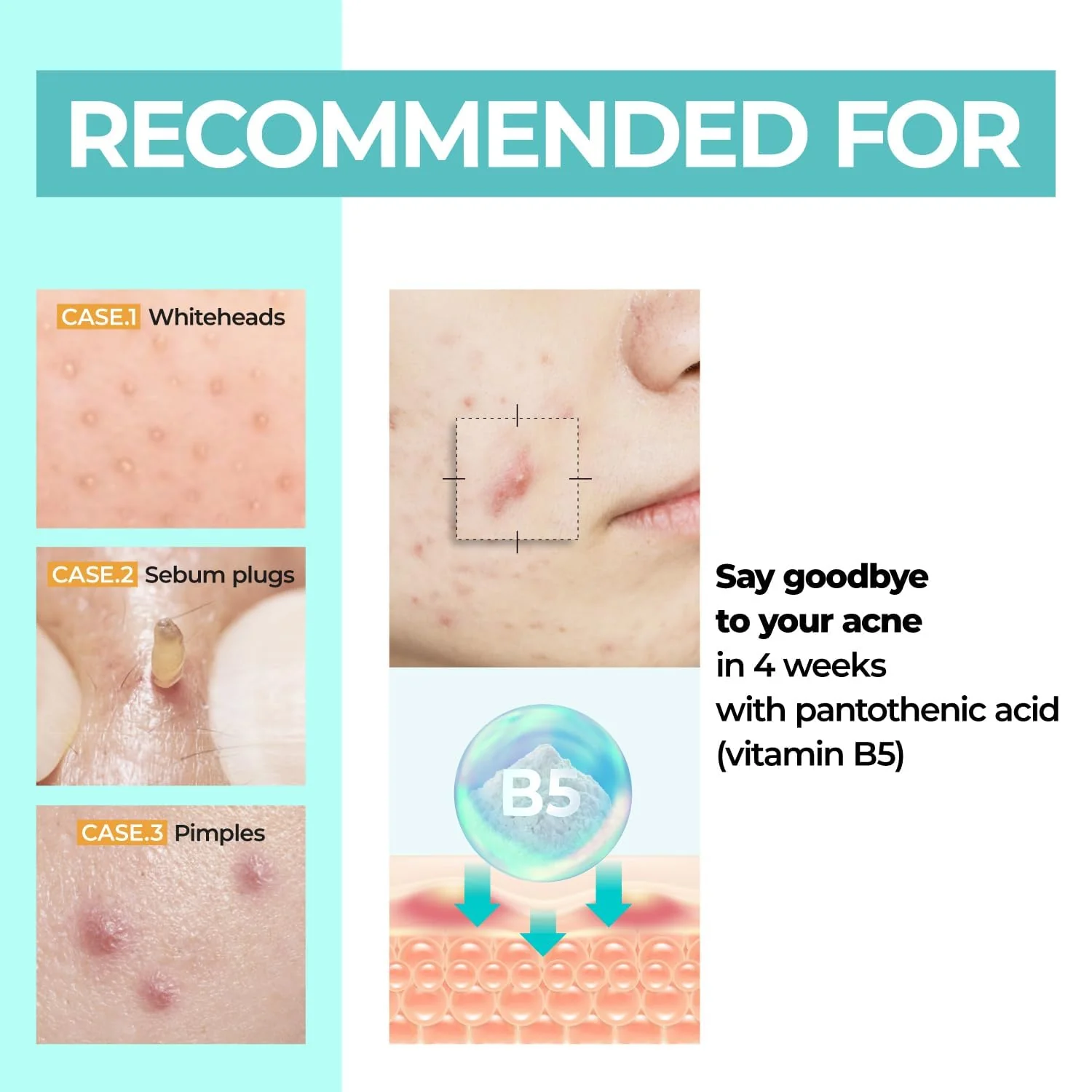 Drėkinantis veido kremas „No.1 Pantothenic B5 Active Soothing Cream“