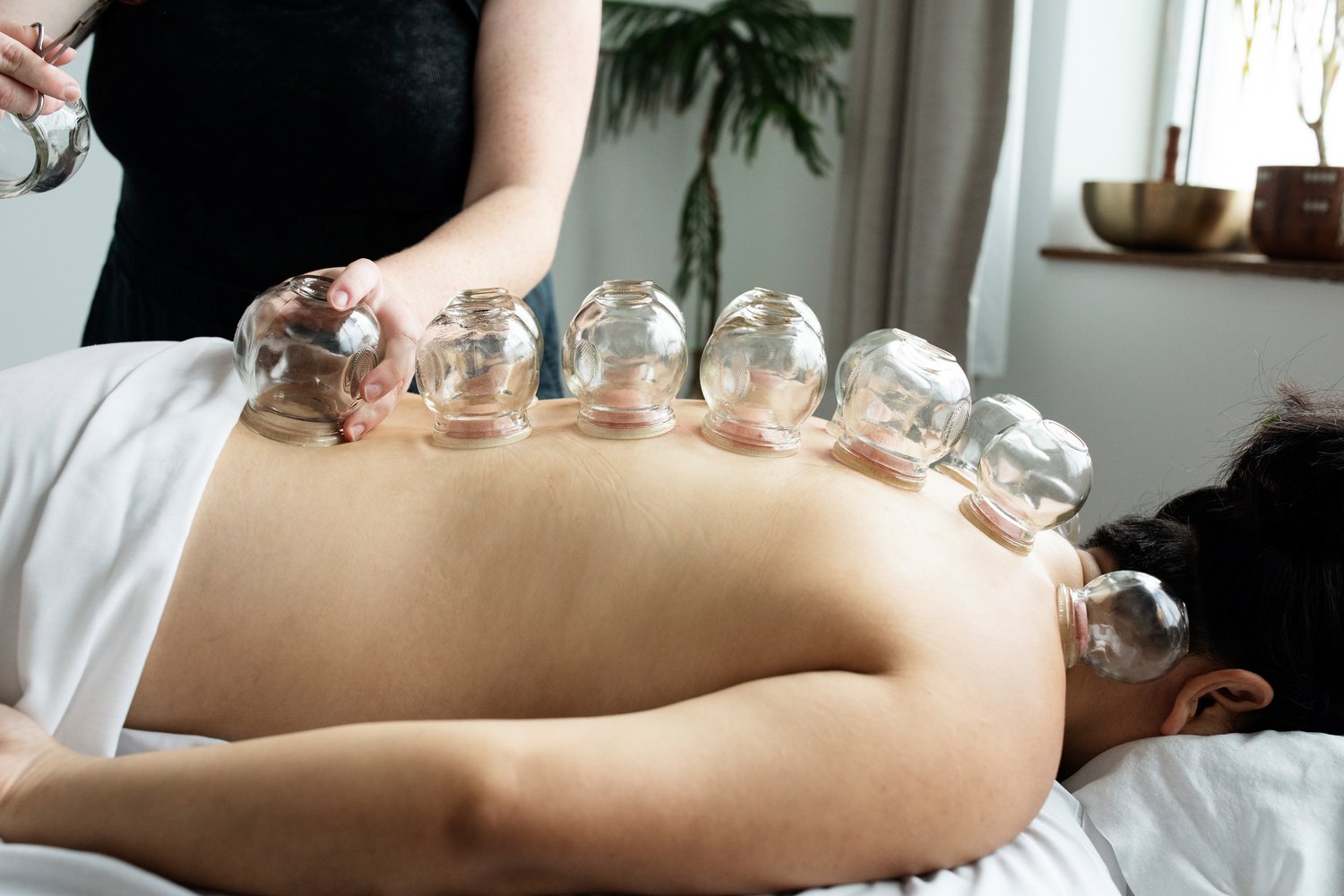 Follow-up Acupuncture