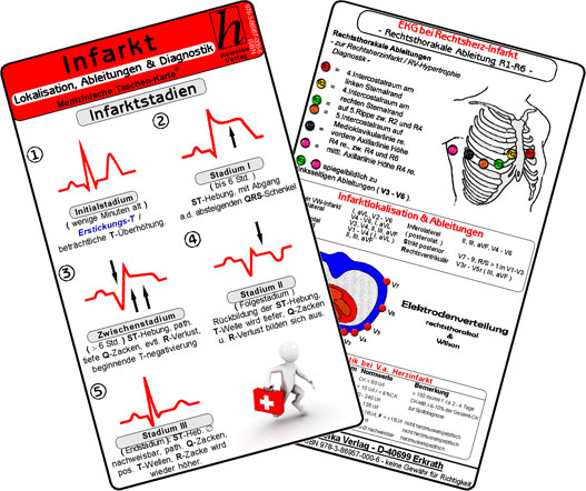 Infarkt - Lokalisation, Ableitungen & Diagnostik