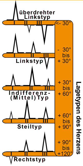 EKG Lineal professional II