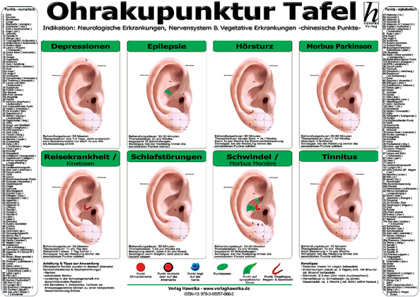 Ohrakupunktur Tafel - Indikation - Neurologische Erkrankungen, Nervensystem & Vegetative Erkrankungen (laminiert) DIN A3