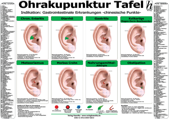 Ohrakupunktur Tafel - Indikation: Gastrointestinale Erkrangungen (laminiert) DIN A3