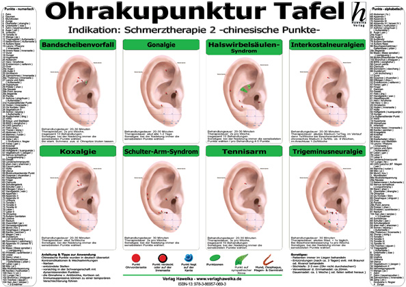 Ohrakupunktur Tafel - Indikation: Schmerztherapie 2 (laminiert) DIN A3