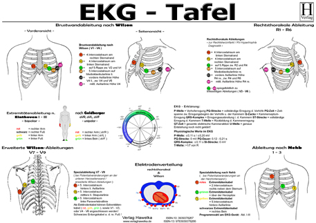 EKG Tafel (laminiert) DIN A3