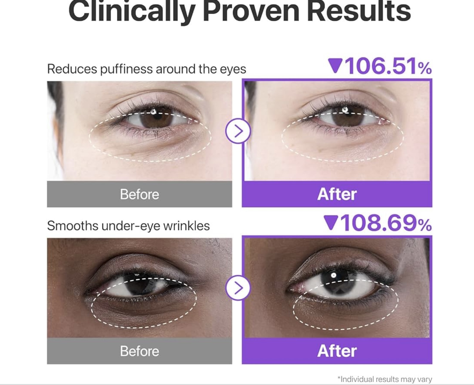 NUMBUZIN COLLAGEN UNDER EYE PATCHES 1 PAR