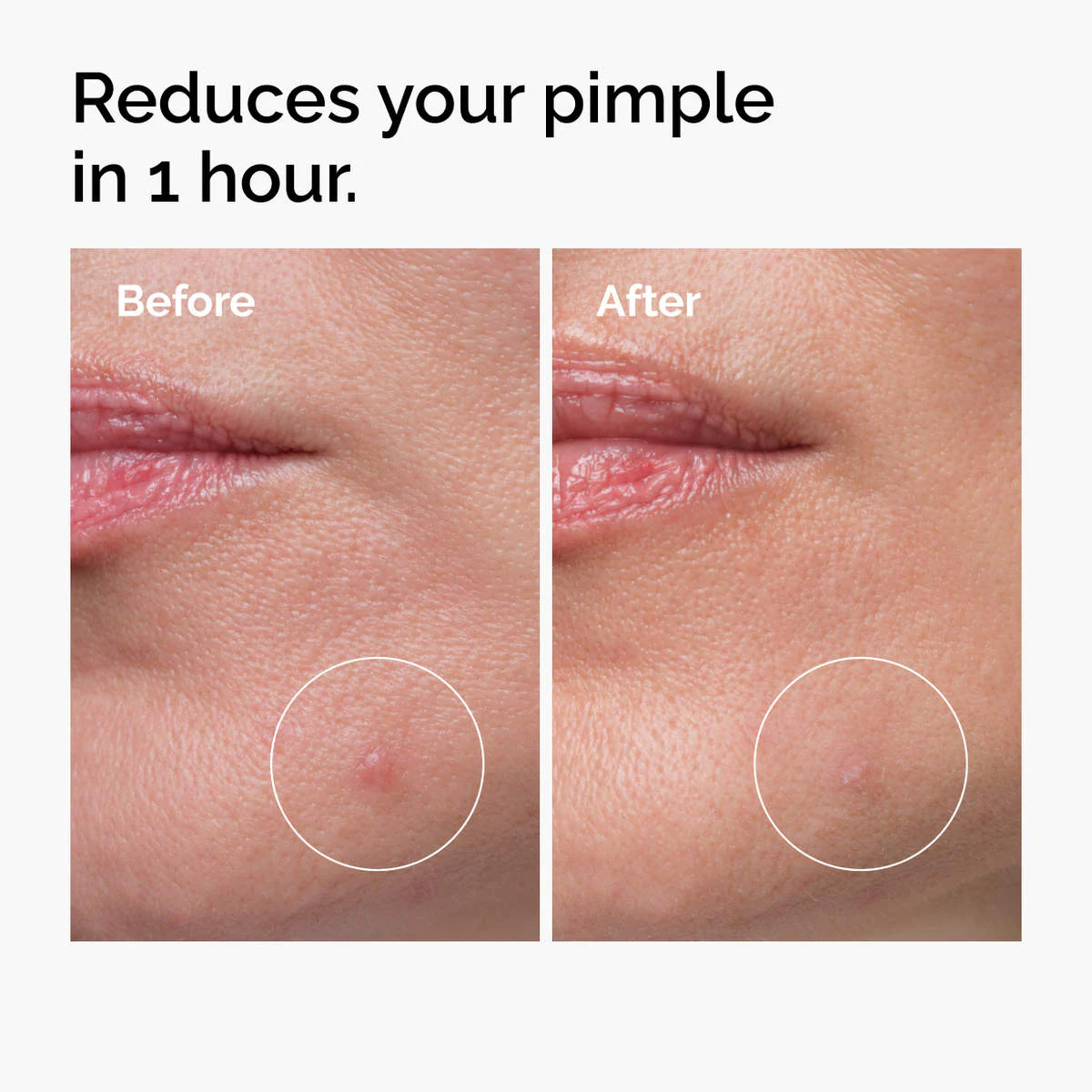 THE ORDINARY SULFUR 10% POWDER TO CREAM CONCENTRATE