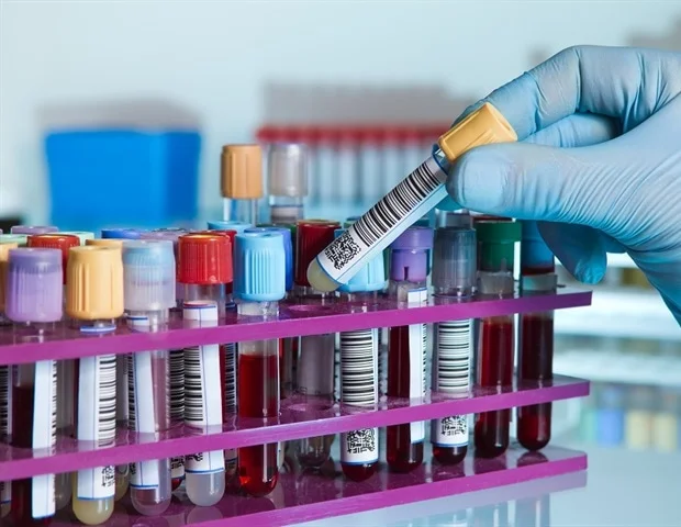 Tree Pollen IgE Positive